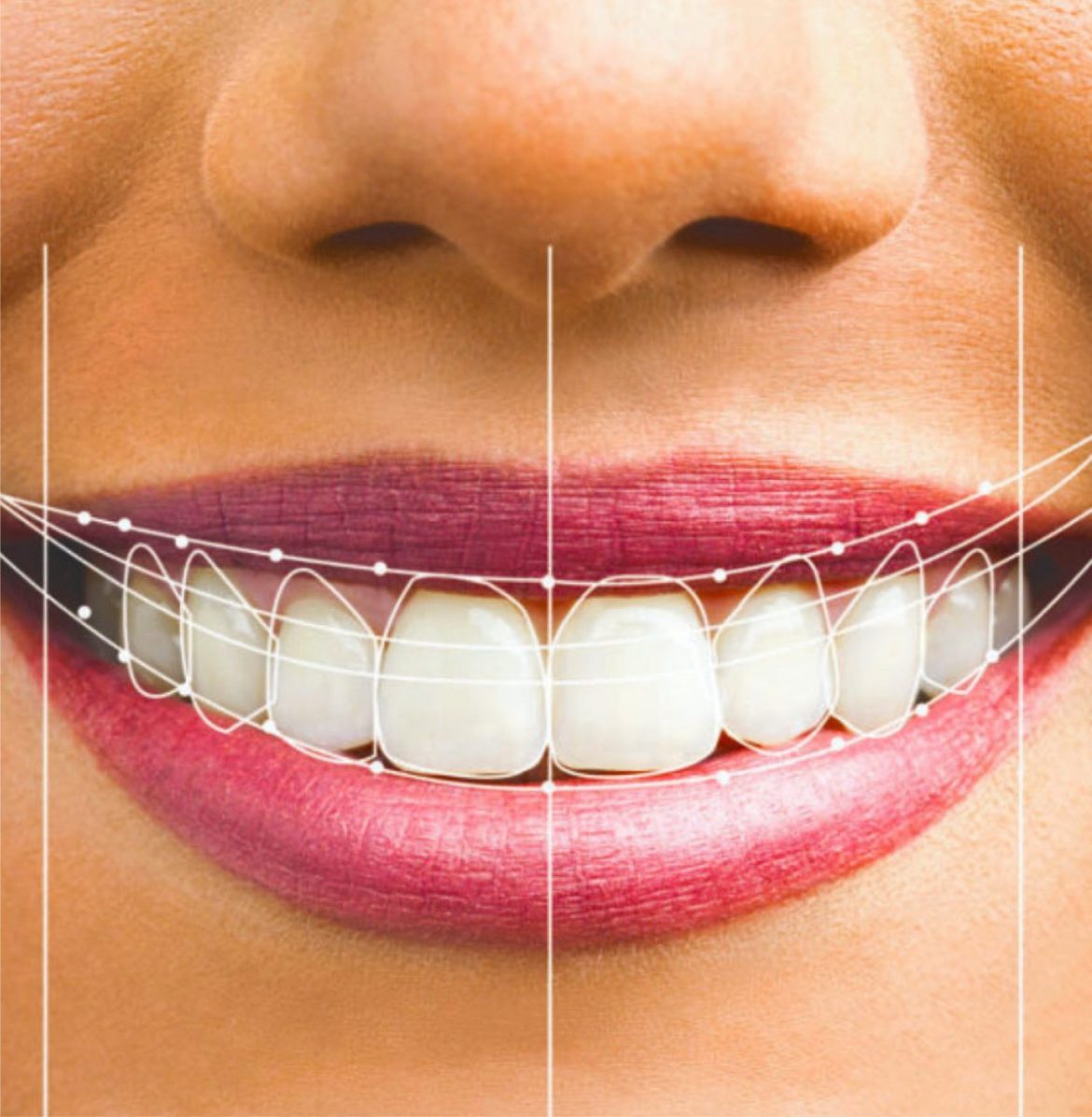 طراحی دیجیتال لبخند